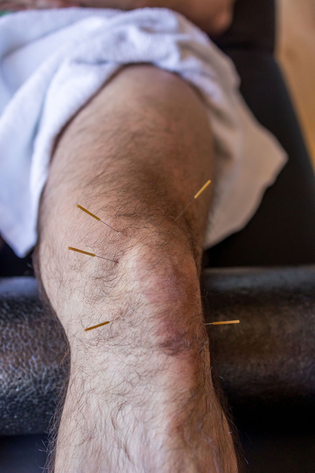 643a8dd916476f42d0de1232beead0b9-xlarge